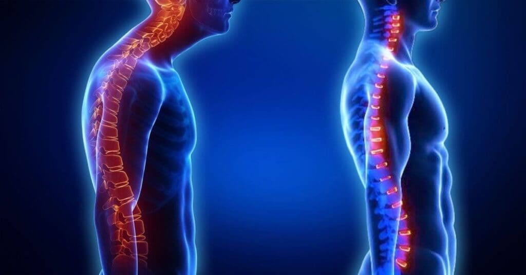 Poor Posture and Spine Pain: Regenerative and Chiropractic Therapies