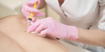 Platelet-Rich Plasma (PRP) Therapy for Spinal Care