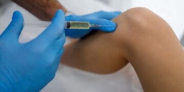 PRP for Meniscus Tears: Integrative Medicine