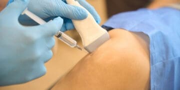 PRP Therapy for Sports Injuries: Non-Surgical Healing