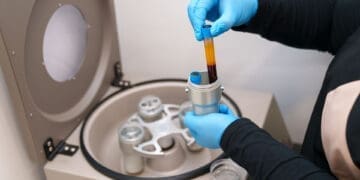 PRP Therapy for Pain Relief, Healing, and Recovery