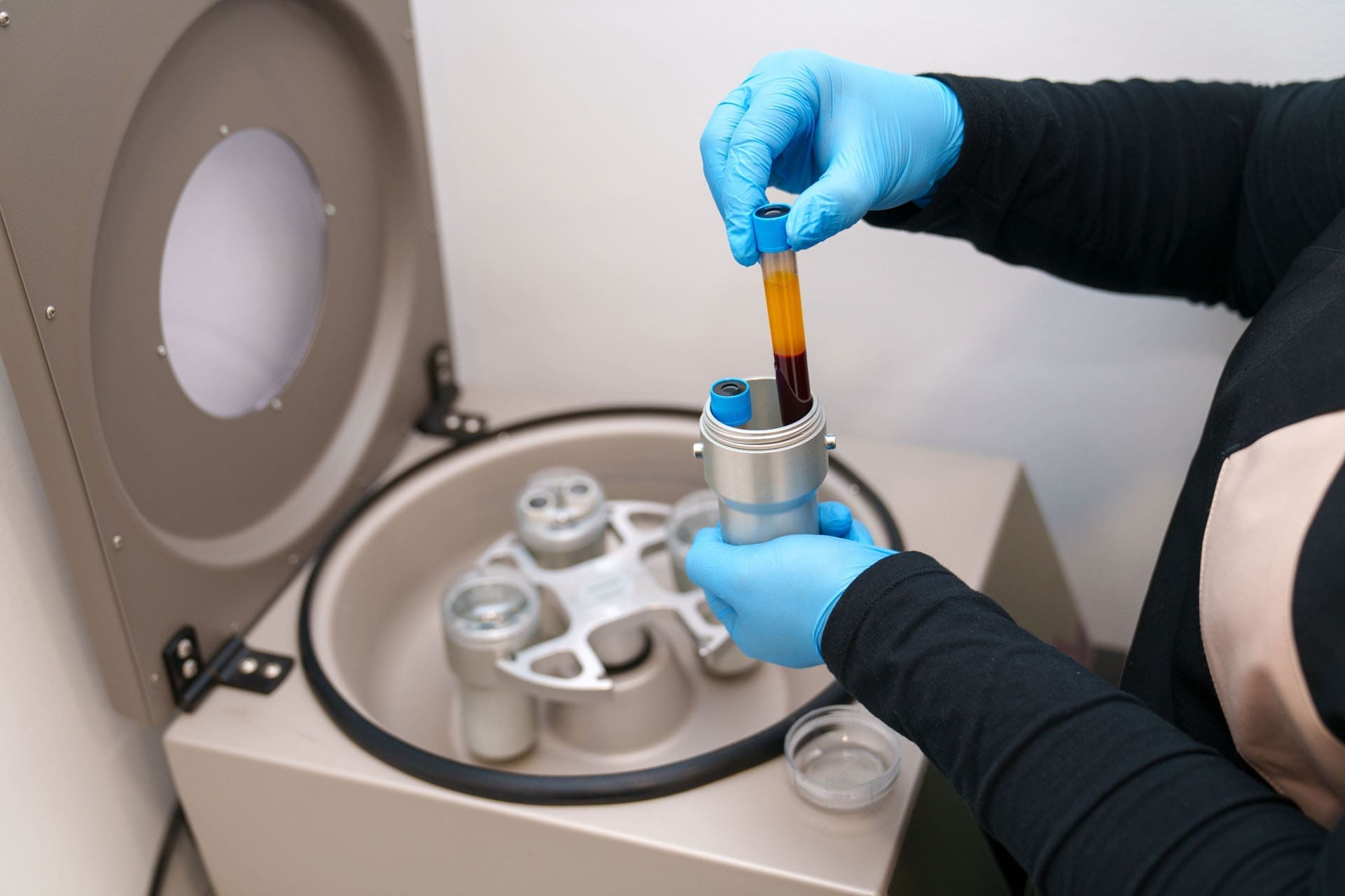 PRP Therapy for Pain Relief, Healing, and Recovery